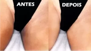 D_NQ_NP_964951-MLB32639653407_102019-O